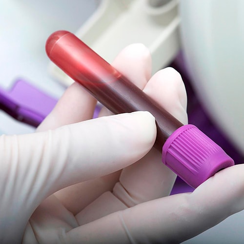 Blood sample taken as part of Occupational Medicine in California